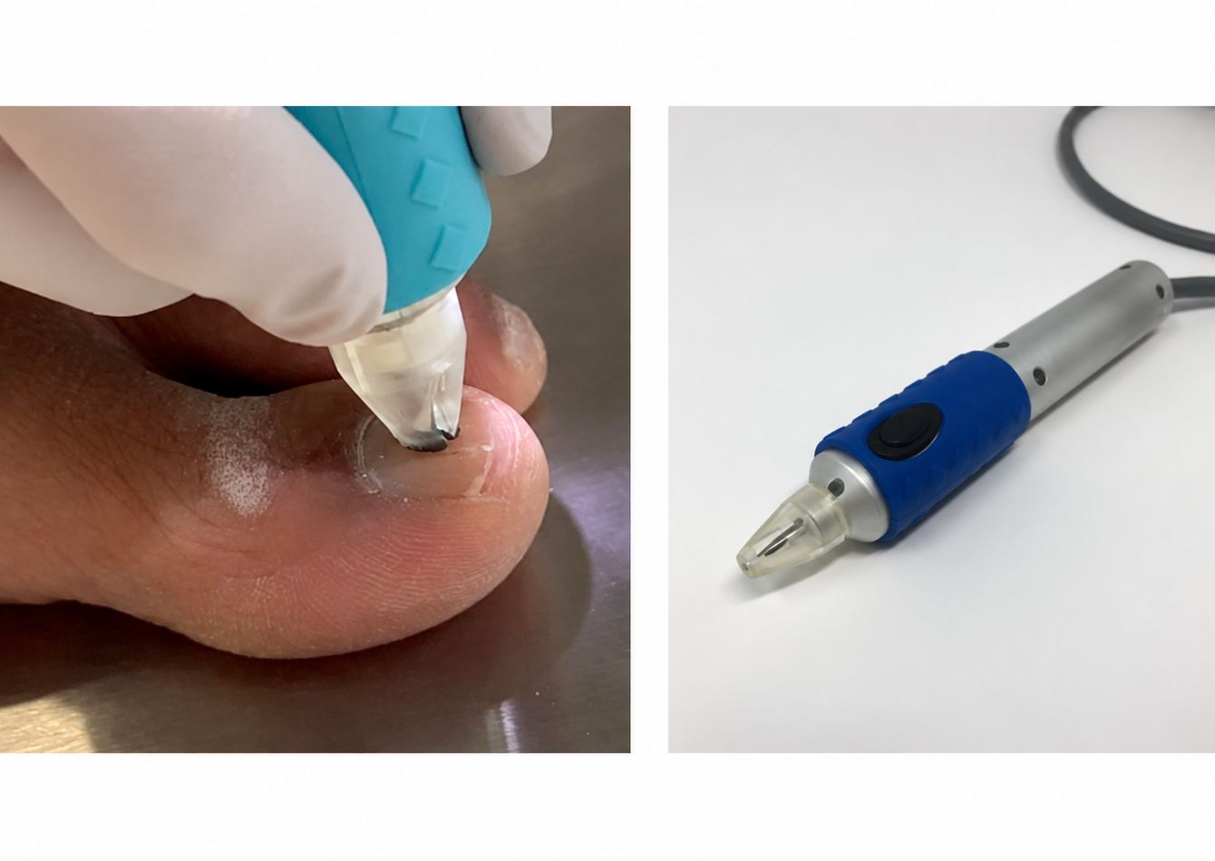 Image of FDA-Cleared Medical Device Platform with Patented Technology